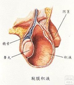 附睾头小 囊肿 斗图表情包大全   与  附睾头小囊