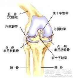 膝盖半月板损伤