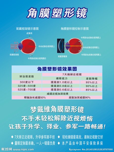 配角膜塑形镜为什么要选择爱尔眼科?