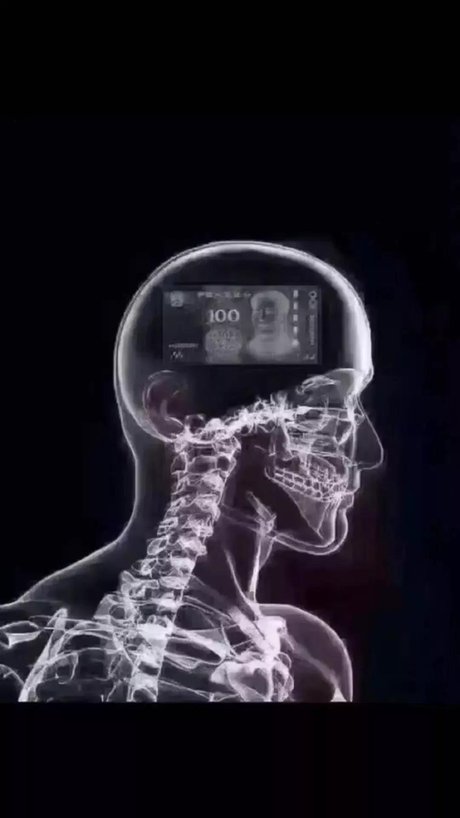 舒适版 双色内饰 相关搜索 mri ct 磁共振 磁共振检查 核磁共振 pet
