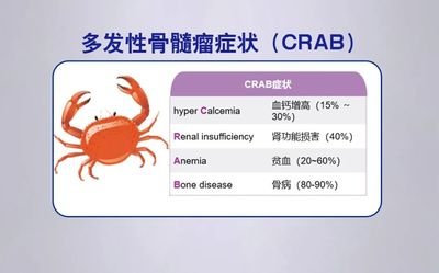 多发性骨髓瘤