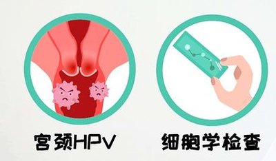 宫颈癌