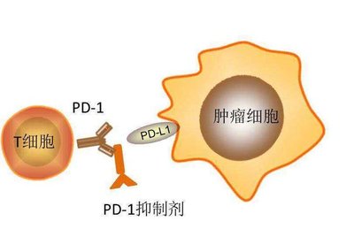 PD-1抑制剂