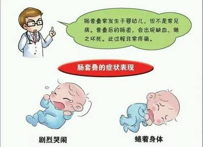 宝宝肠套叠怎么办