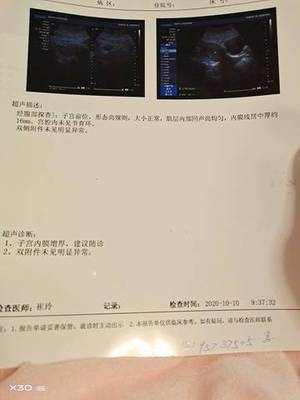 怀孕检测报告单