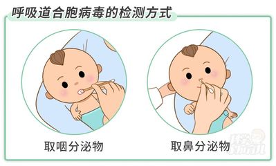 先咳嗽后发烧属于哪种