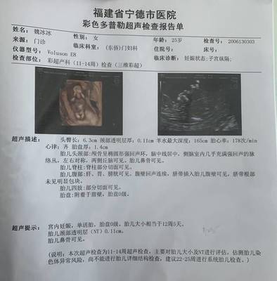 怀孕半个月会流产吗