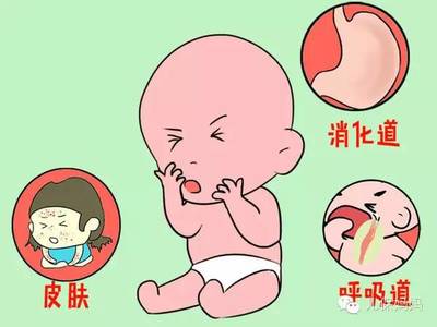 宝宝母乳过敏