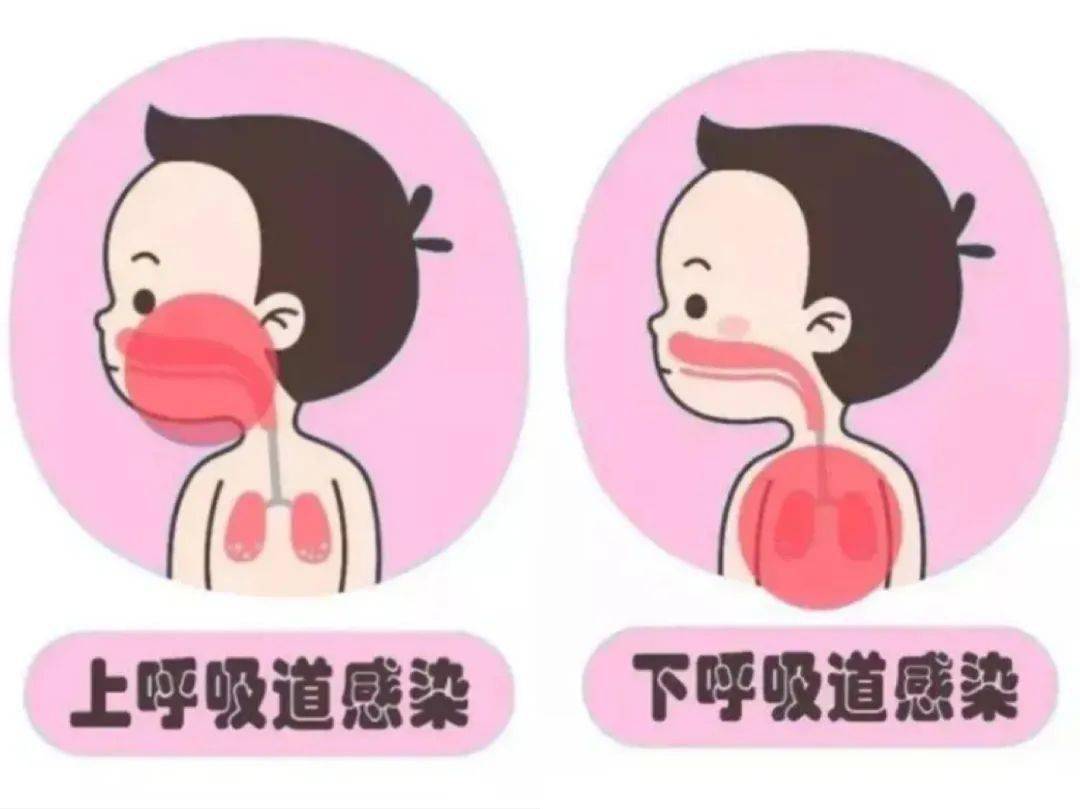宝宝上呼吸道感染症状