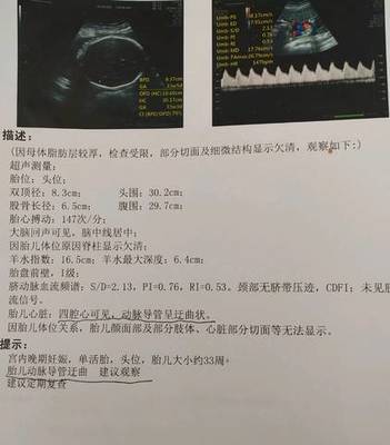 33周胎儿发育情况