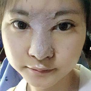 隆鼻打几天消炎针