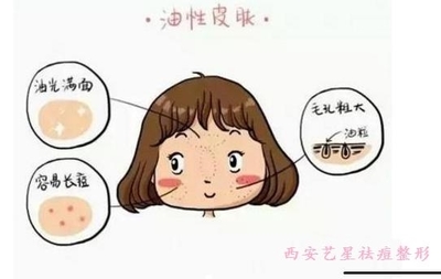 维生素a祛痘