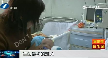 两个月婴儿贫血