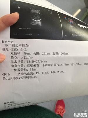 怀孕两周胎儿有多大