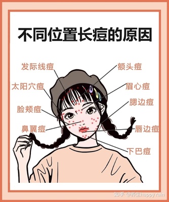 额头有痘痘是因为什么原因