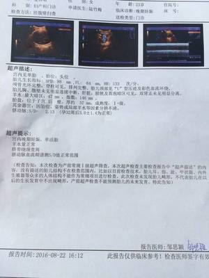 怀孕38周胎儿双顶径多少正常