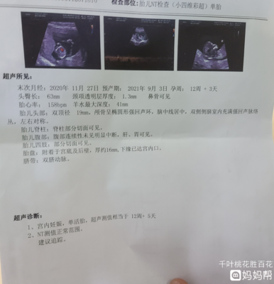 nt是查胎儿什么的