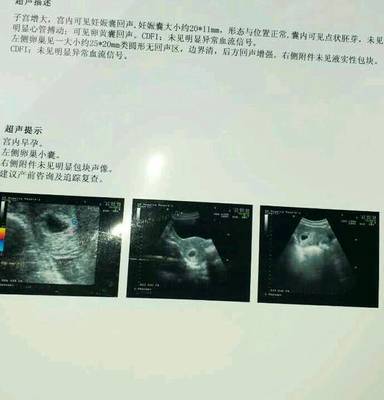 怀孕初期吃了克拉霉素