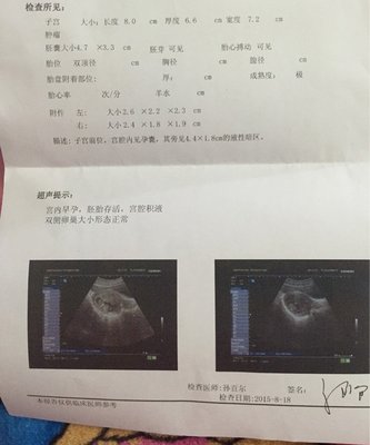 怀孕10周体温应该多少正常