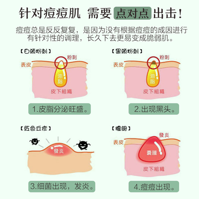 痘痘肌的四个成因