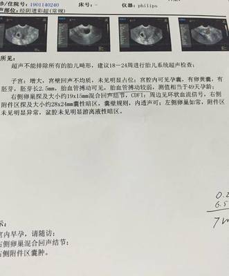 怀孕24周肚子疼是怎么回事