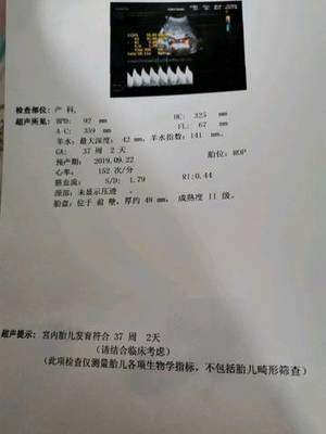 孕36周后胎儿一周一般能长重