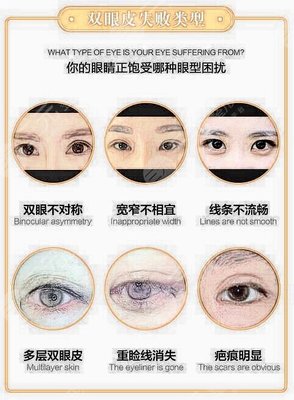 八大处整形美容眼睛