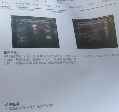 甲状腺血流速度多少正常值