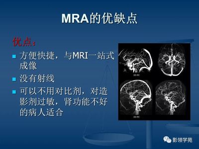 mra和cta的区别