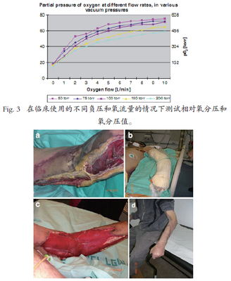 手臂筋膜炎怎么治疗最有效