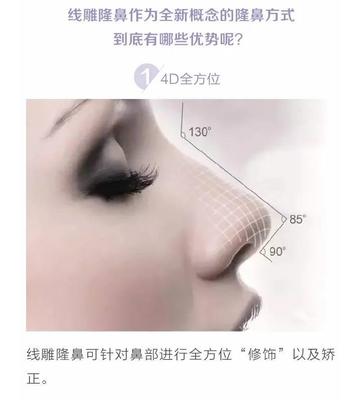 线雕隆鼻和玻尿酸区别