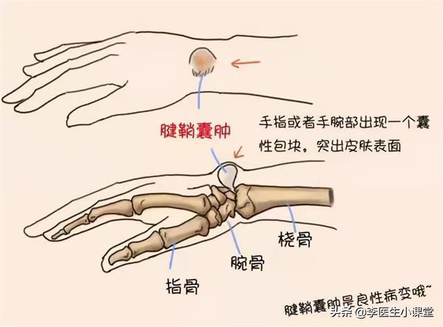 肿怎么治疗