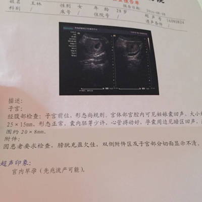 怀孕一个月内会出血吗