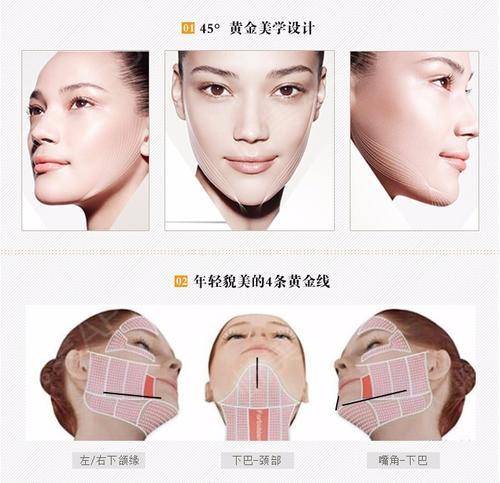 埋线提升脸