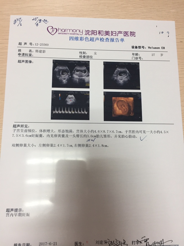 胎儿10周有多大