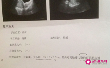 怀孕四十五天有什么反应