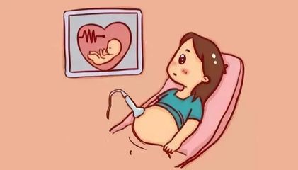 胎儿胎心