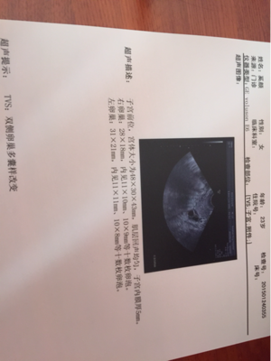 双侧卵巢多囊会怀孕吗