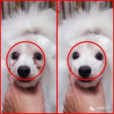 泪管堵塞怎么治疗