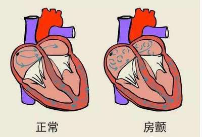 心脏膨胀瘤怎么治疗