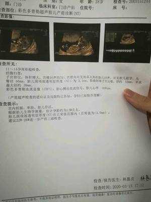 怀孕一个月能染头发吗