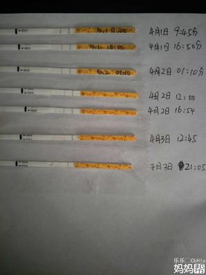 胸部疼一个星期了怎么回事