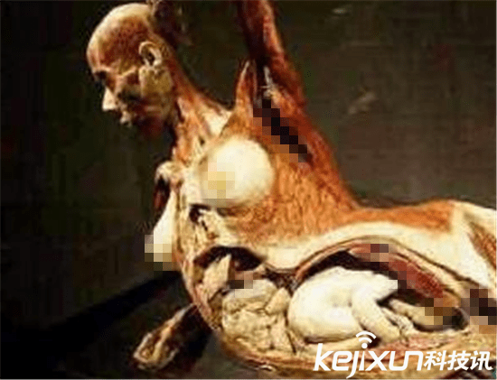 大连孕妇标本