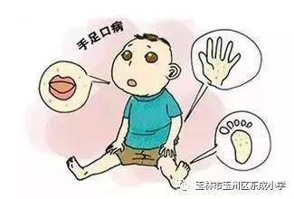 宝宝口腔疱疹怎么治疗