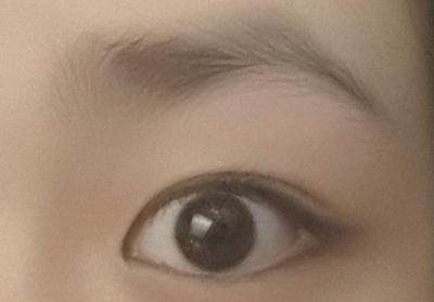 桃花眼必须是双眼皮吗