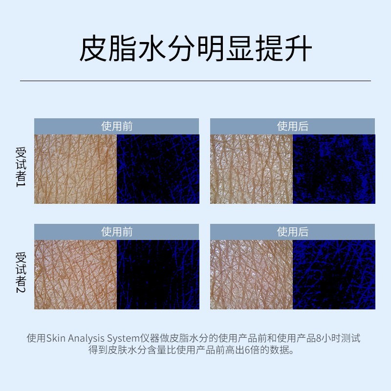 玻尿酸水光原液