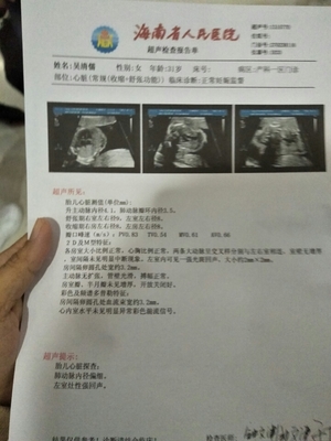 怀孕十一周胎儿会动吗