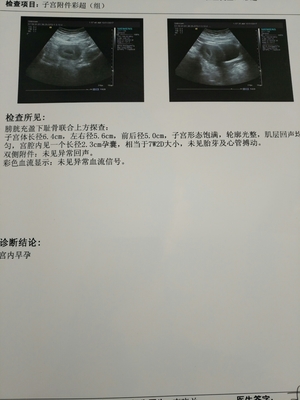 怀孕6周彩超图片
