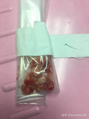 拔牙后眼睛肿了怎么办