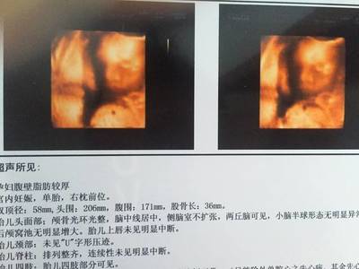 怀孕6个多月胎动少正常吗